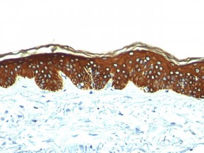 Cytokeratin, HMW Monoclonal Mouse Antibody (AE-3)