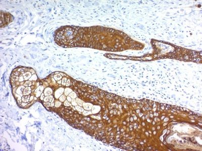 Cytokeratin, HMW Monoclonal Mouse Antibody (KRTH/1076)