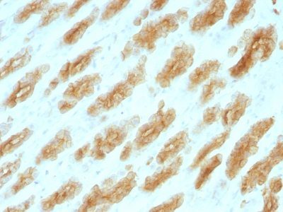 Cytokeratin, HMW Monoclonal Mouse Antibody (KRTH/1076)