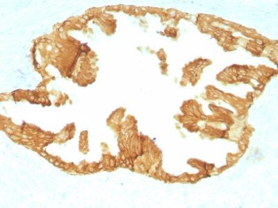 Cytokeratin, HMW Monoclonal Mouse Antibody (KRTH/1076)