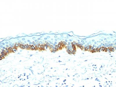 Cytokeratin, LMW Monoclonal Mouse Antibody (AE-1)