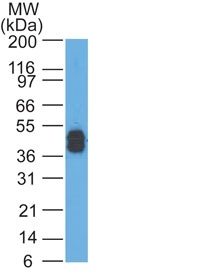 Cytokeratin, LMW Monoclonal Mouse Antibody (AE-1)