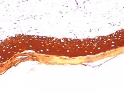Cytokeratin, LMW Monoclonal Mouse Antibody (KRTL/1077)