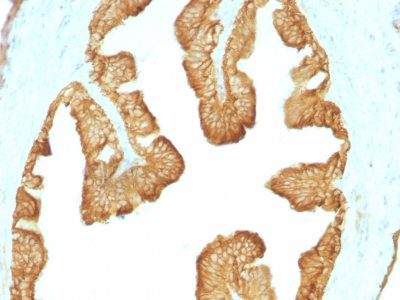 Cytokeratin, LMW Monoclonal Mouse Antibody (KRTL/1077)