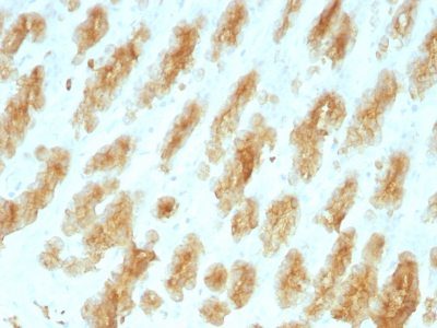 Cytokeratin, LMW Monoclonal Mouse Antibody (KRTL/1077)