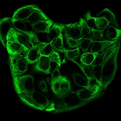 Cytokeratin, Multi Monoclonal Mouse Antibody (C11)