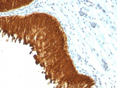 Cytokeratin, Multi Monoclonal Mouse Antibody (KRT/457)