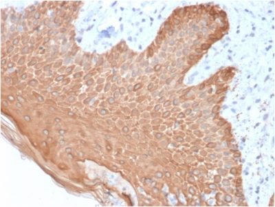 Cytokeratin, Multi Recombinant Monoclonal Mouse Antibody (rKRT/457)