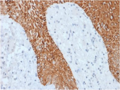Cytokeratin, Multi Recombinant Monoclonal Rabbit Antibody (KRT/1877R)