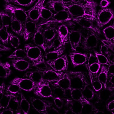 Cytokeratin, Pan Monoclonal Mouse Antibody (Cocktail)