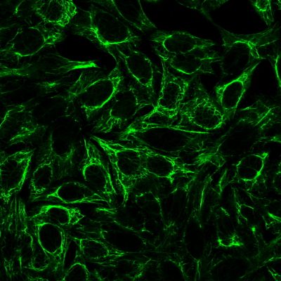 Cytokeratin, Pan Monoclonal Mouse Antibody (Cocktail)