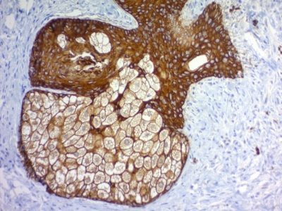 Cytokeratin, Pan Monoclonal Mouse Antibody (Cocktail)