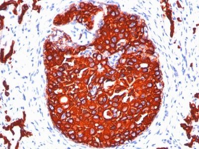 Cytokeratin, Pan Monoclonal Mouse Antibody (KRTL/1077 + KRTH/1076)