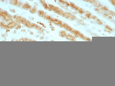 Cytokeratin, Pan Monoclonal Mouse Antibody (KRTL/1077 + KRTH/1076)