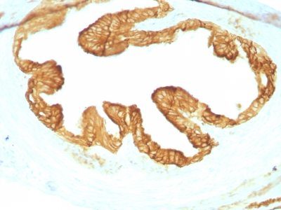Cytokeratin, Pan Monoclonal Mouse Antibody (KRTL/1077 + KRTH/1076)