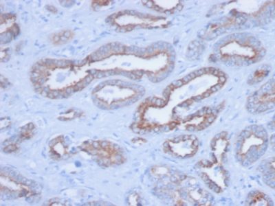 Cytokeratin, Pan Monoclonal Mouse Antibody (PCK/3150)