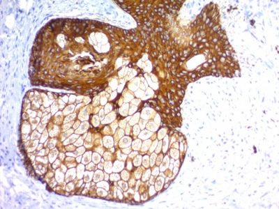 Cytokeratin, Pan Recombinant Monoclonal Rabbit Antibody (KRTH/1576R + KRTL/1577R)
