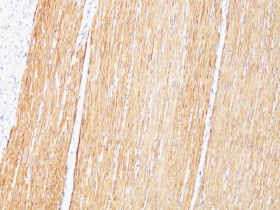 Desmin Monoclonal Mouse Antibody (D33)