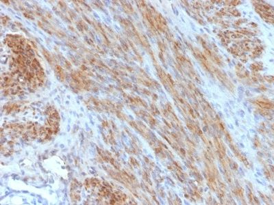 Desmin Monoclonal Mouse Antibody (DES/1711)