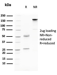 Desmoglein-3 Monoclonal Mouse Antibody (DSG3/2796)