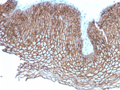 Desmoglein-3 Monoclonal Mouse Antibody (DSG3/2837)