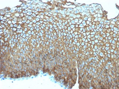 Desmoglein-3 Monoclonal Mouse Antibody (DSG3/2839)