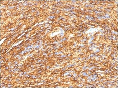 DOG-1 / TMEM16A Monoclonal Mouse Antibody (DG1/1484)