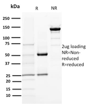 DOG-1 / TMEM16A Monoclonal Mouse Antibody (DG1/1484)