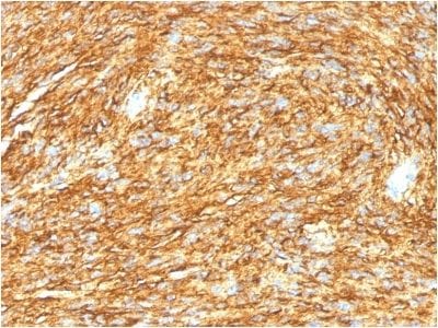 DOG-1 / TMEM16A Monoclonal Mouse Antibody (DG1/1485)