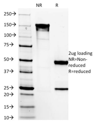 DOG-1 / TMEM16A Monoclonal Mouse Antibody (DG1/1485)