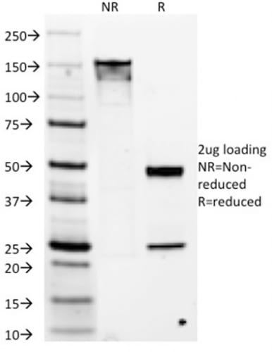 DOG-1 / TMEM16A Monoclonal Mouse Antibody (DG1/1486)