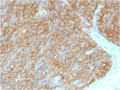 DOG-1 / TMEM16A Monoclonal Mouse Antibody (DG1/1486)
