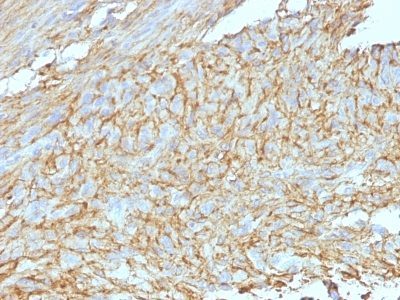 DOG-1 / TMEM16A Monoclonal Mouse Antibody (DG1/447 + DOG1.1)