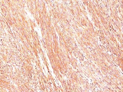 DOG-1 / TMEM16A Monoclonal Mouse Antibody (DG1/447)