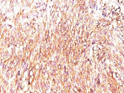 DOG-1 / TMEM16A Monoclonal Mouse Antibody (DOG1.1)