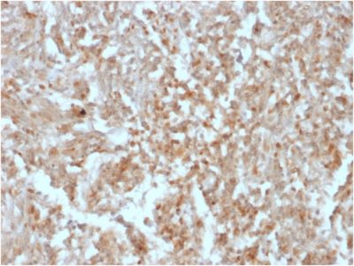 DOG-1 / TMEM16A Recombinant Monoclonal Mouse Antibody (rDG1/447)