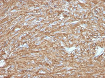 DOG-1 / TMEM16A Recombinant Monoclonal Rabbit Antibody (DG1/2831R)