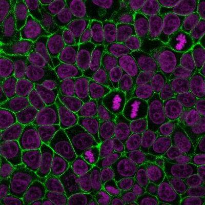 E-Cadherin / CD324 Monoclonal Mouse Antibody (4A2)