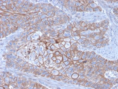 E-Cadherin / CD324 Monoclonal Mouse Antibody (CDH1/3256)