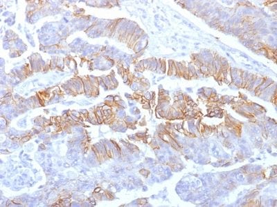 E-Cadherin / CD324 Recombinant Monoclonal Mouse Antibody (rCDH1/1525)