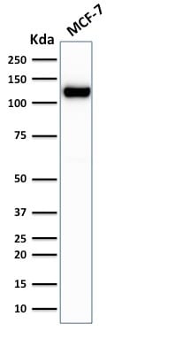 E-Cadherin / CD324 Recombinant Monoclonal Mouse Antibody (rCDH1/1525)