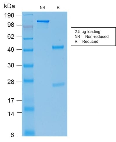 E-Cadherin / CD324 Recombinant Monoclonal Mouse Antibody (rCDH1/1525)