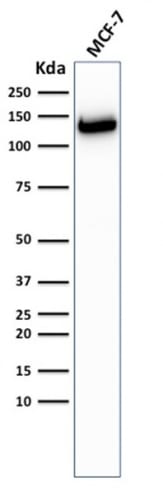 E-Cadherin / CD324 Recombinant Monoclonal Rabbit Antibody (CDH1/2208R)