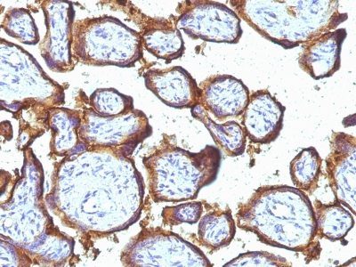 EGFR Monoclonal Mouse Antibody (31G7)