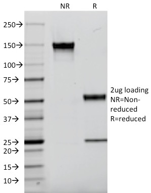 EGFR Monoclonal Mouse Antibody (F4)