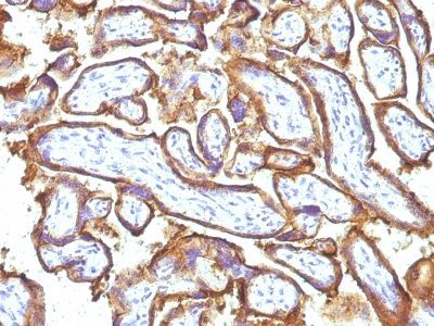 EGFR Monoclonal Mouse Antibody (GFR1195 + 31G7)