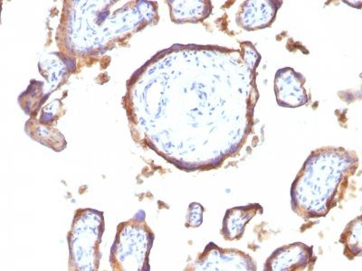 EGFR Monoclonal Mouse Antibody (GFR1195)