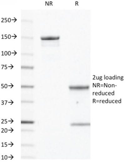EGFR Monoclonal Mouse Antibody (GFR450)