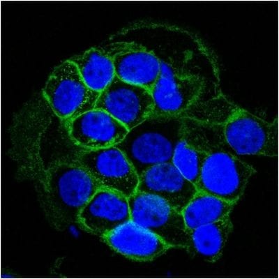EGFR Monoclonal Mouse Antibody (GFR450)