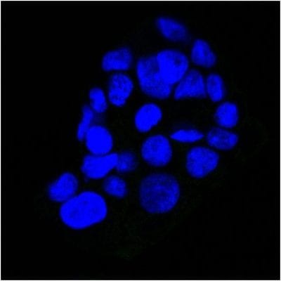 EGFR Monoclonal Mouse Antibody (GFR450)